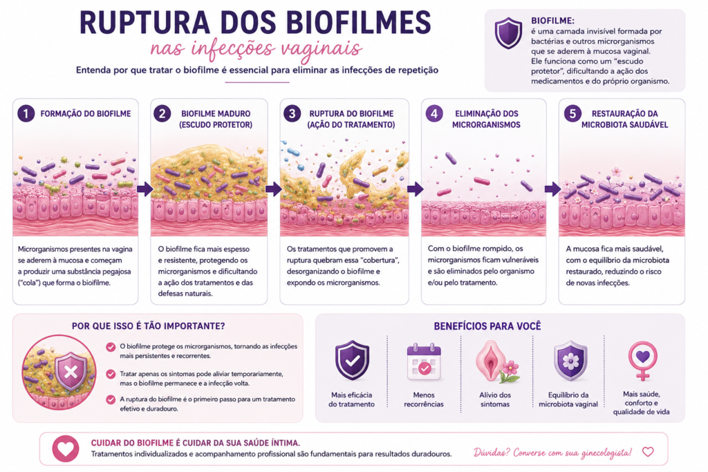 “Ilustração demonstrando a formação, ruptura e eliminação de biofilmes em infecções vaginais recorrentes, mostrando a restauração da microbiota vaginal saudável após o tratamento.”