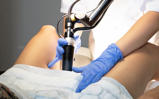 laser para tratamento intimo
